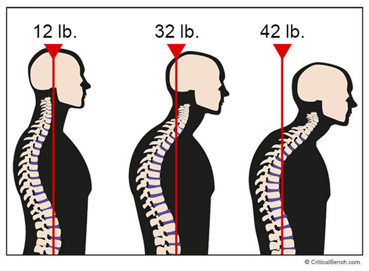 forward-head-posture2.gif